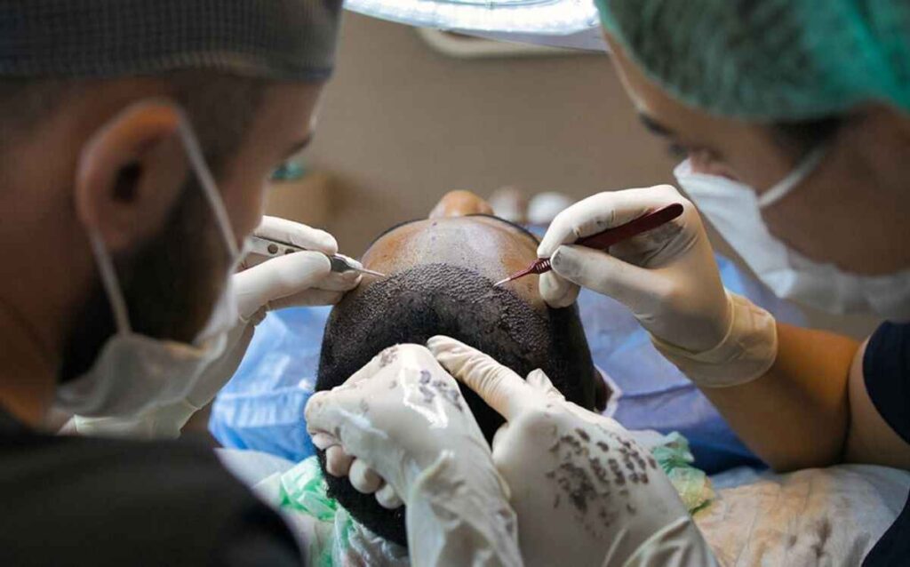 Hair Transplant Mistakes